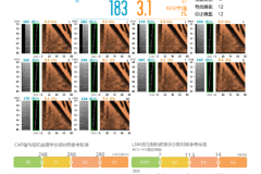 FibroScan® 无创肝脏诊断设备的结果解读：洞察肝脏健康的“密码”