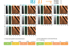 FibroScan® 无创肝脏诊断设备的结果解读：洞察肝脏健康的“密码”